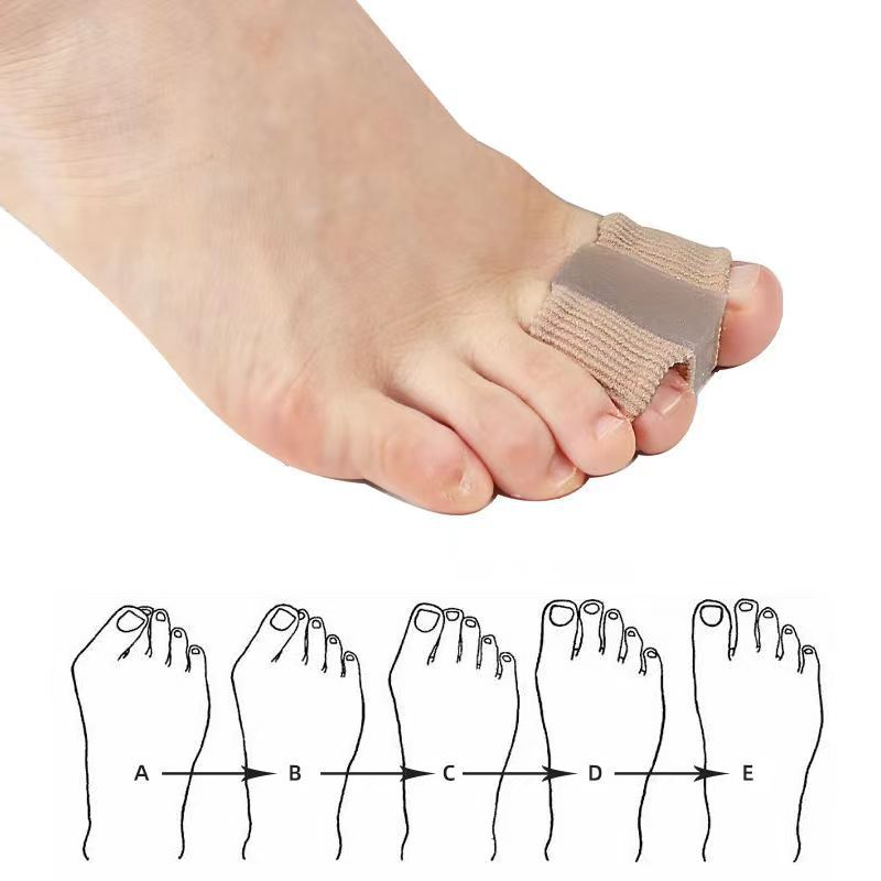 Fiber Toe Separators