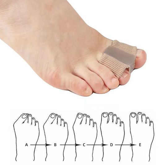 Fiber Toe Separators